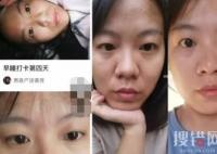 女子打卡286天坚持10点睡觉 黑眼圈淡了原因实在始料未及