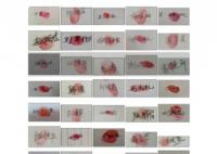 38位戈谢病患者家庭联名求药 照片曝光直接让人大呼意外