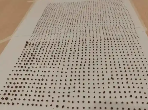 64岁大爷体内取出1791颗结石 始料未及真相简直太意外了