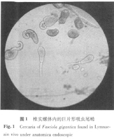 生吃水产会感染寄生虫？